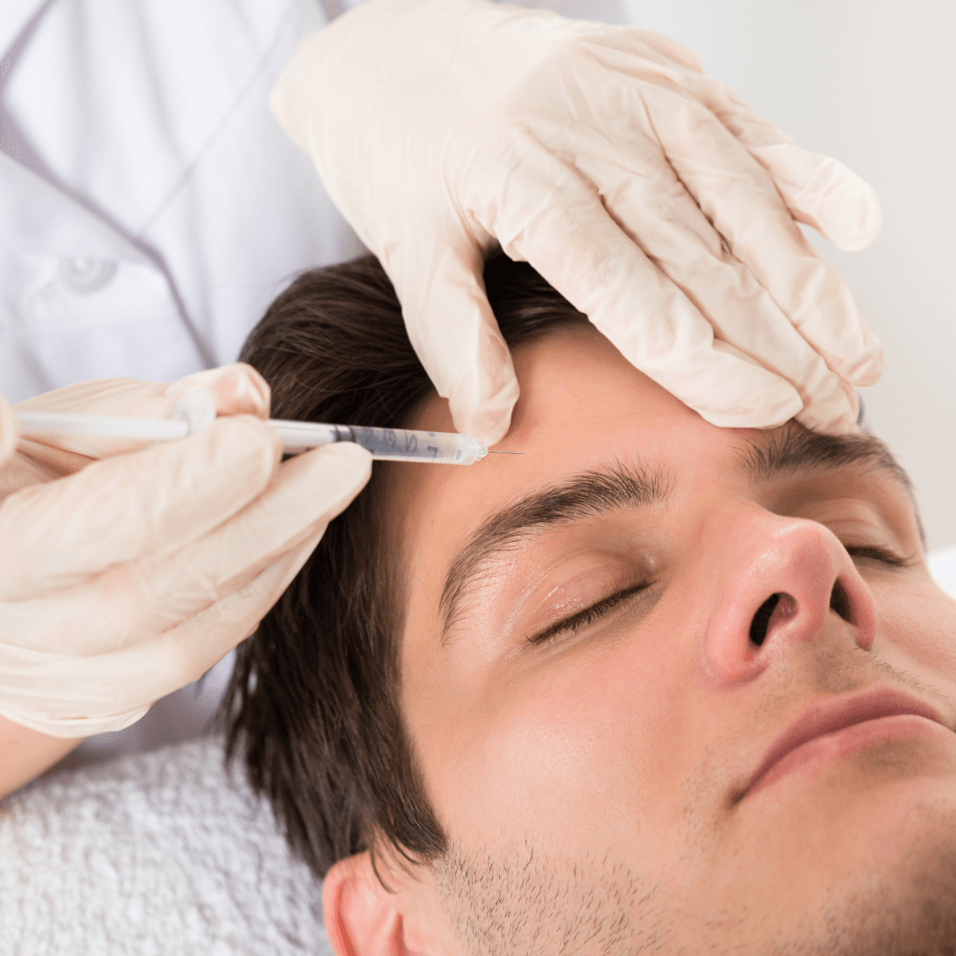 Tratamiento con neuromoduladores Aplicación de un tratamiento con neuromoduladores a un hombre en la frente.