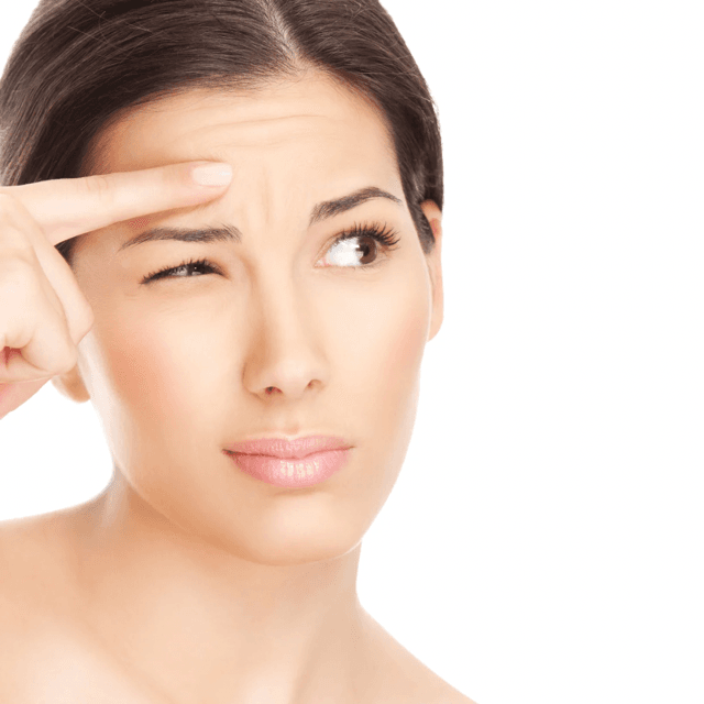 Tratamientos con neuromoduladores en Granada para líneas de expresión. Mujer preocupada por líneas de expresión en la frente, ideal para tratamientos con neuromoduladores en Granada.