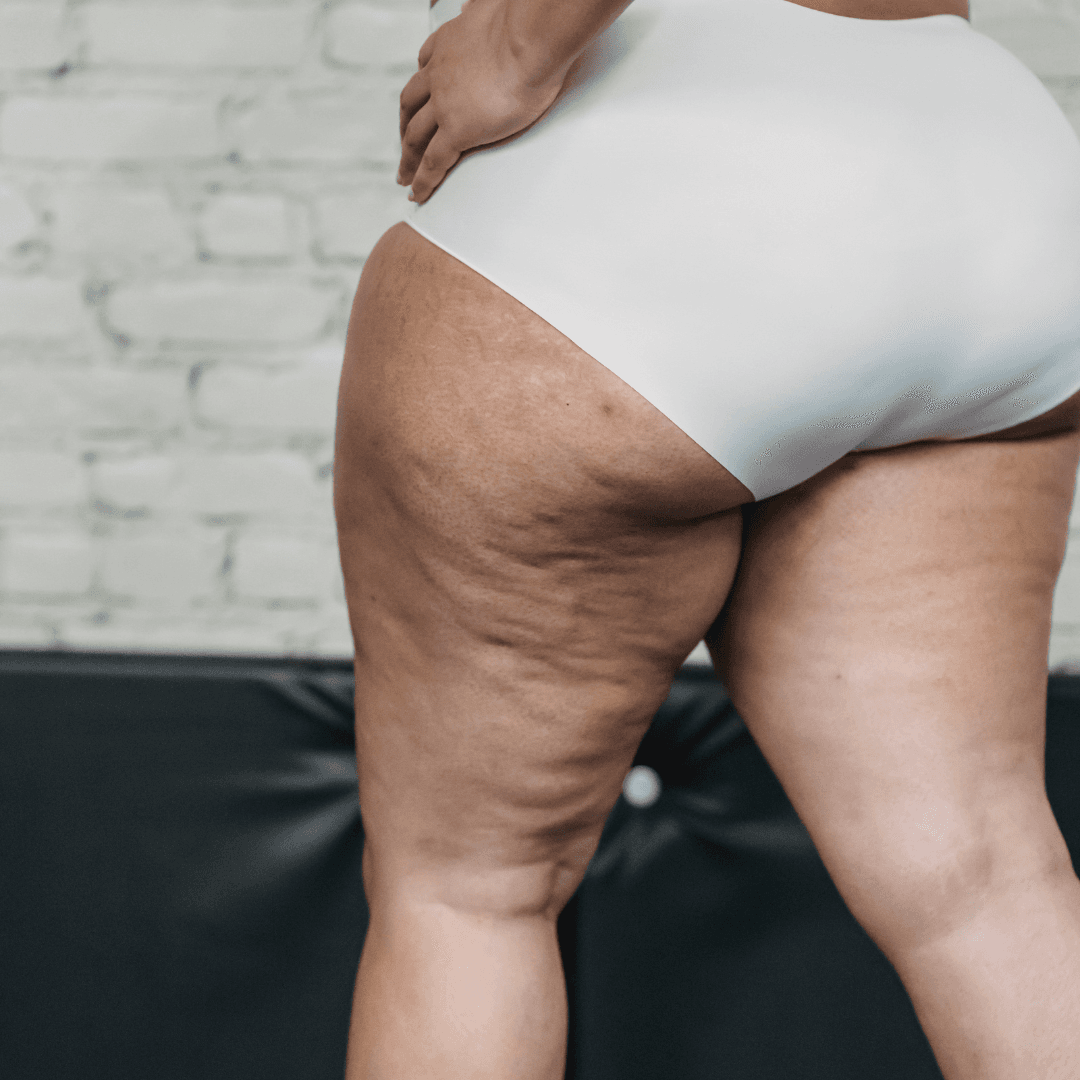 BLACK FRIDAY MESOTERAPIA QUEMA GRASAS 8 SESIONES + LIPO ACTIVE/DETOX 1 BLACK FRIDAY MESOTERAPIA QUEMA GRASAS 8 SESIONES + LIPO ACTIVE/DETOX