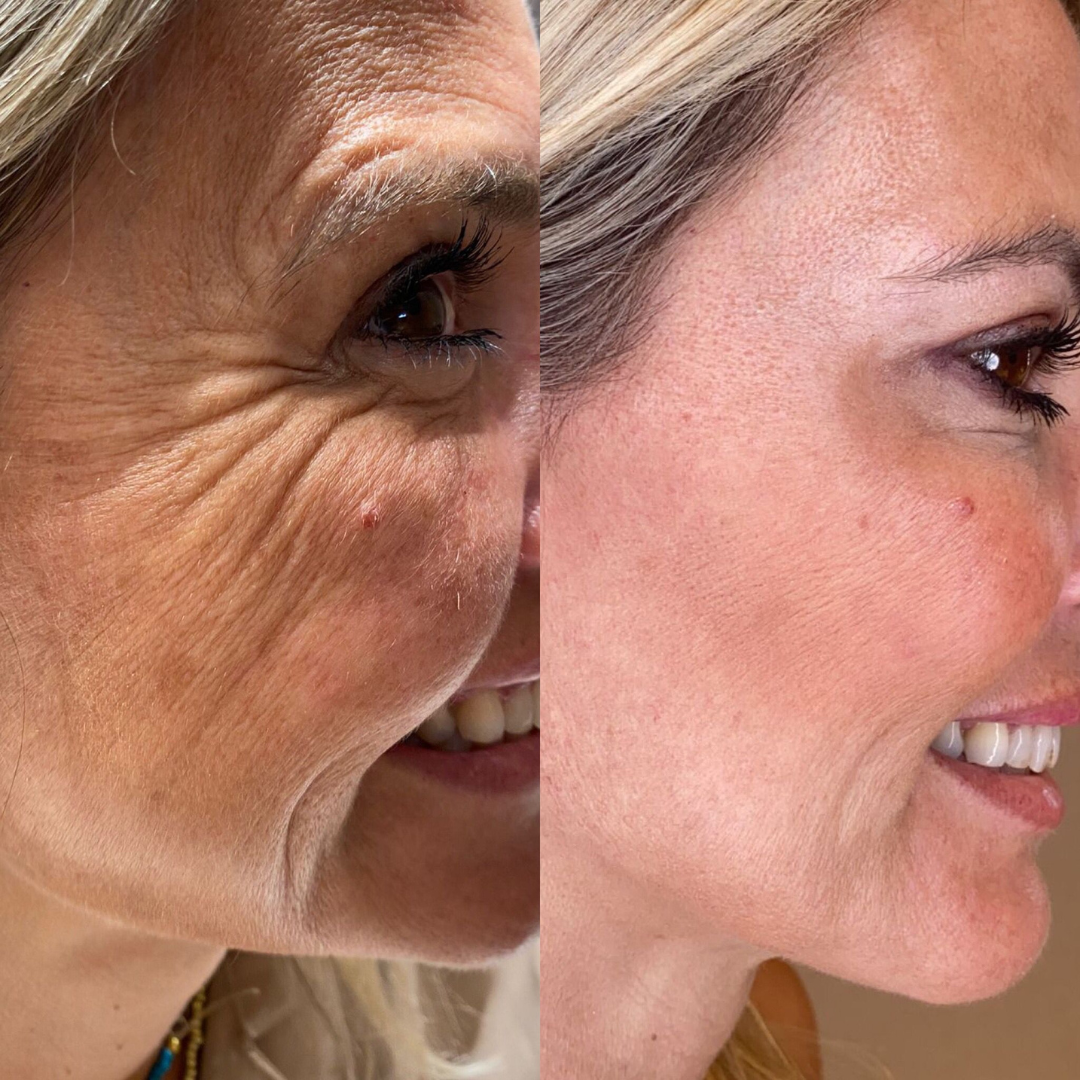 CAJA MAGICA-REDENSIFICACION FACIAL 2ML+ AMINOACIDOS 2 CAJA MAGICA-REDENSIFICACION FACIAL 2ML+ AMINOACIDOS - Imagen 2