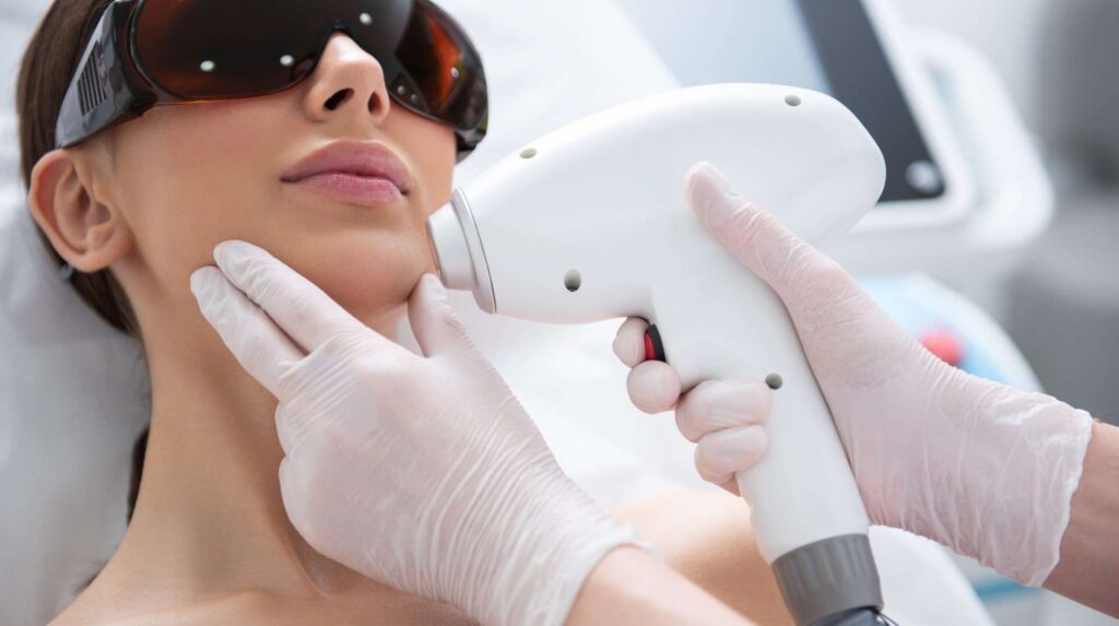 depilacion laser