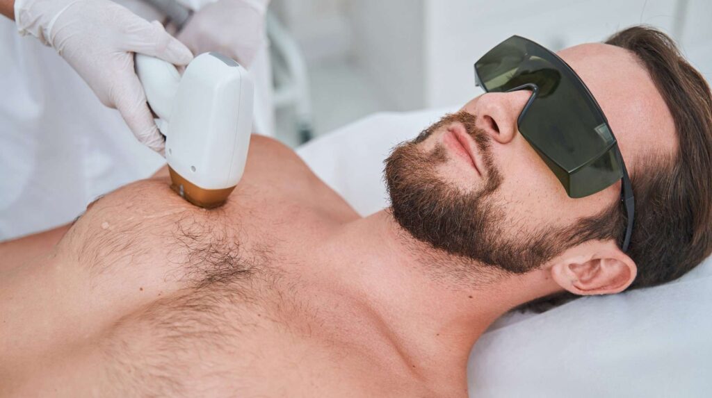 depilacion con laser