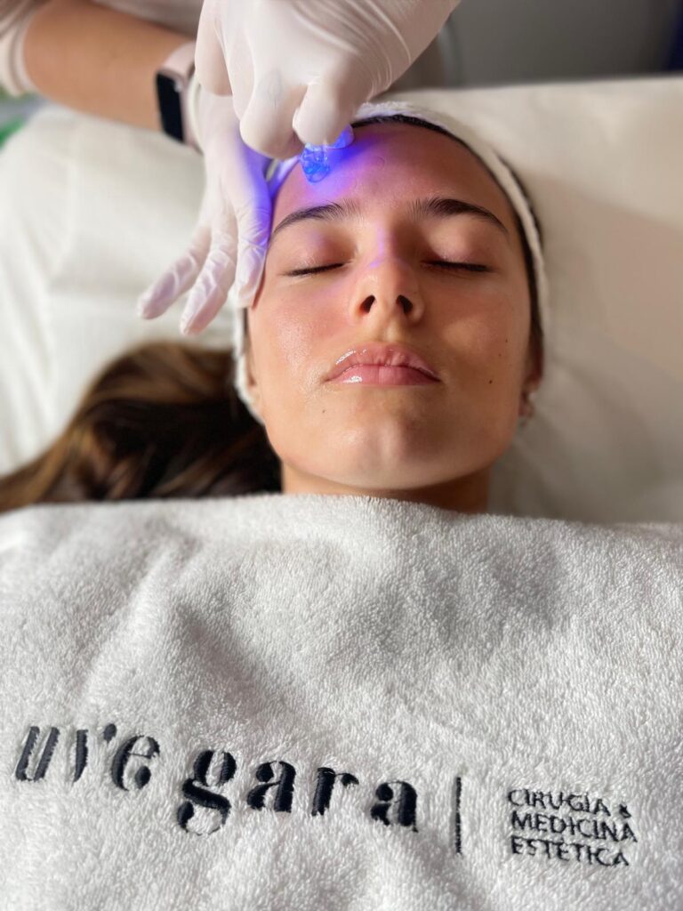 Acné en verano: causas, prevención y tratamientos efectivos 2 tratamientos para el acne en verano