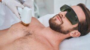 depilacion laser claves para cuidar tu p 4