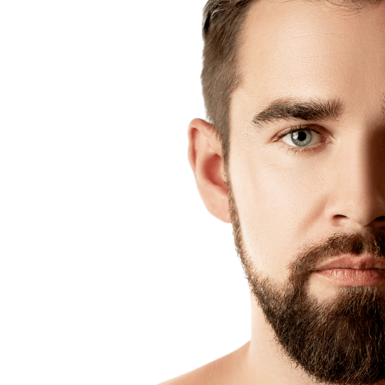 Rellenos Faciales en Granada - Tratamientos con Ácido Hialurónico para Hombres Hombre con piel rejuvenecida tras tratamientos de rellenos faciales con ácido hialurónico en Granada.