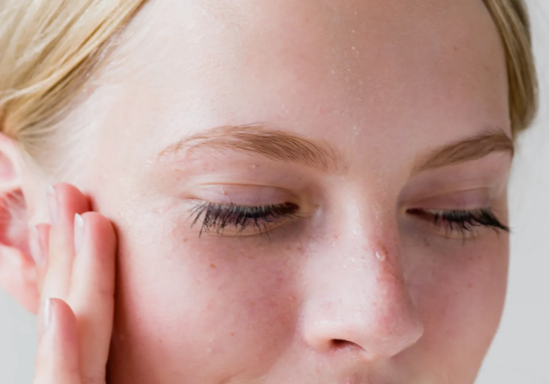 Pieles sensibles_ Un enfoque especializado