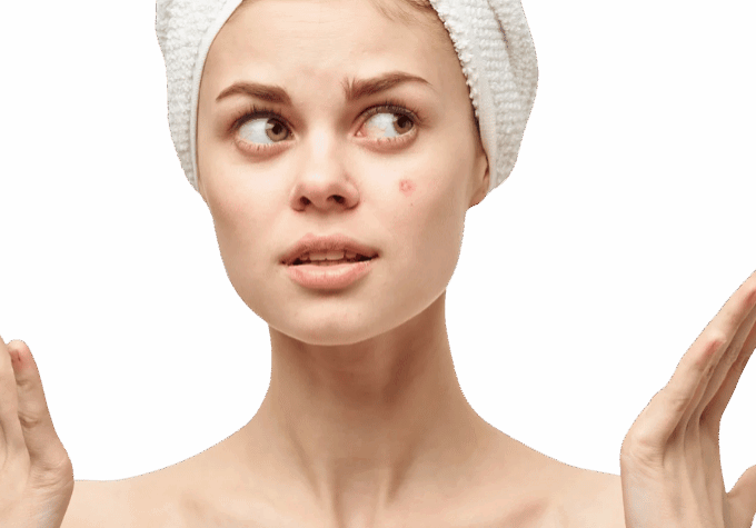 Tipos de marcas en la cara (y cómo se tratan)