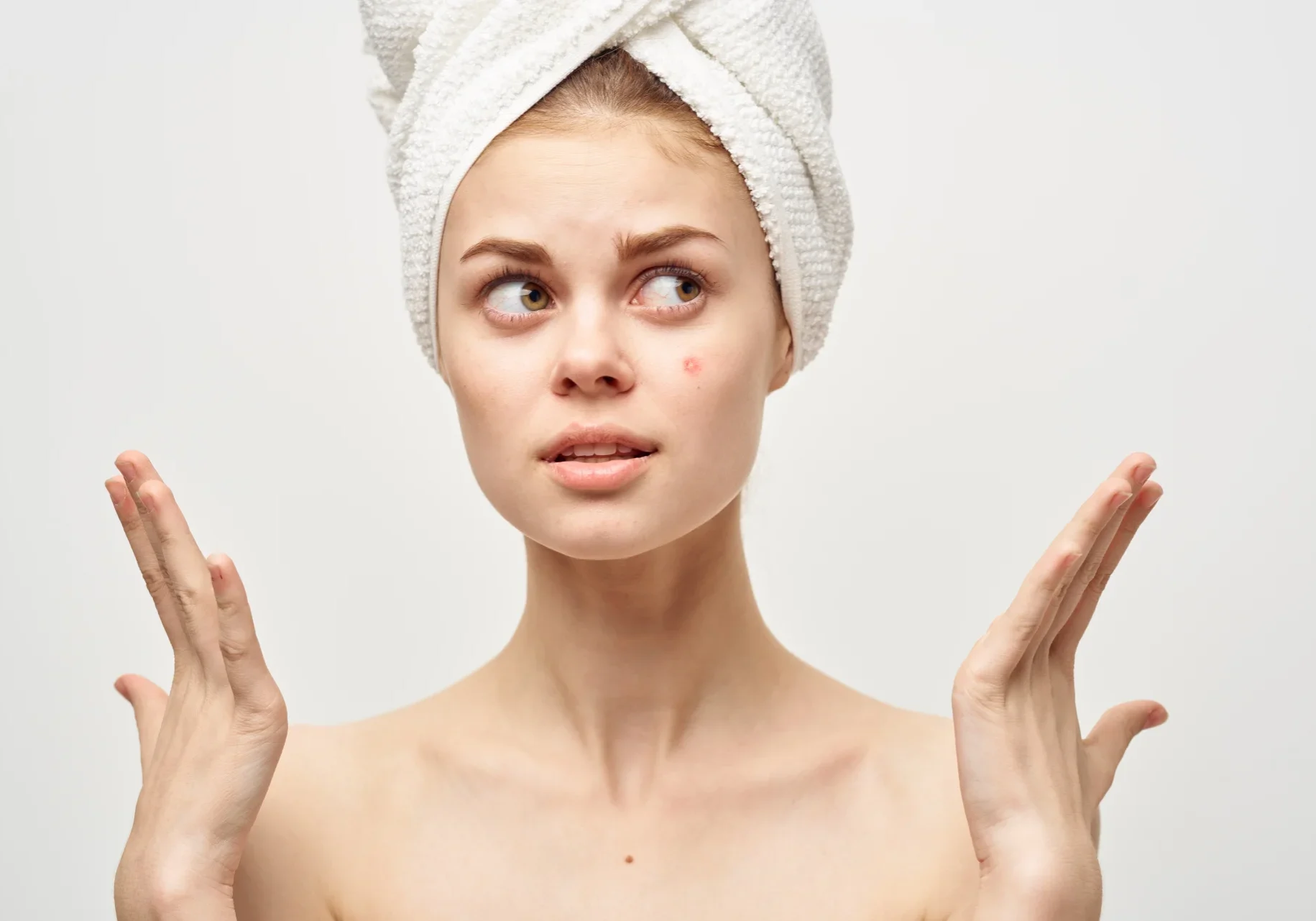 beautiful-woman-bare-shoulders-dermatology-isolate-2025-03-11-18-01-14-utc beautiful-woman-bare-shoulders-dermatology-isolate-2025-03-11-18-01-14-utc