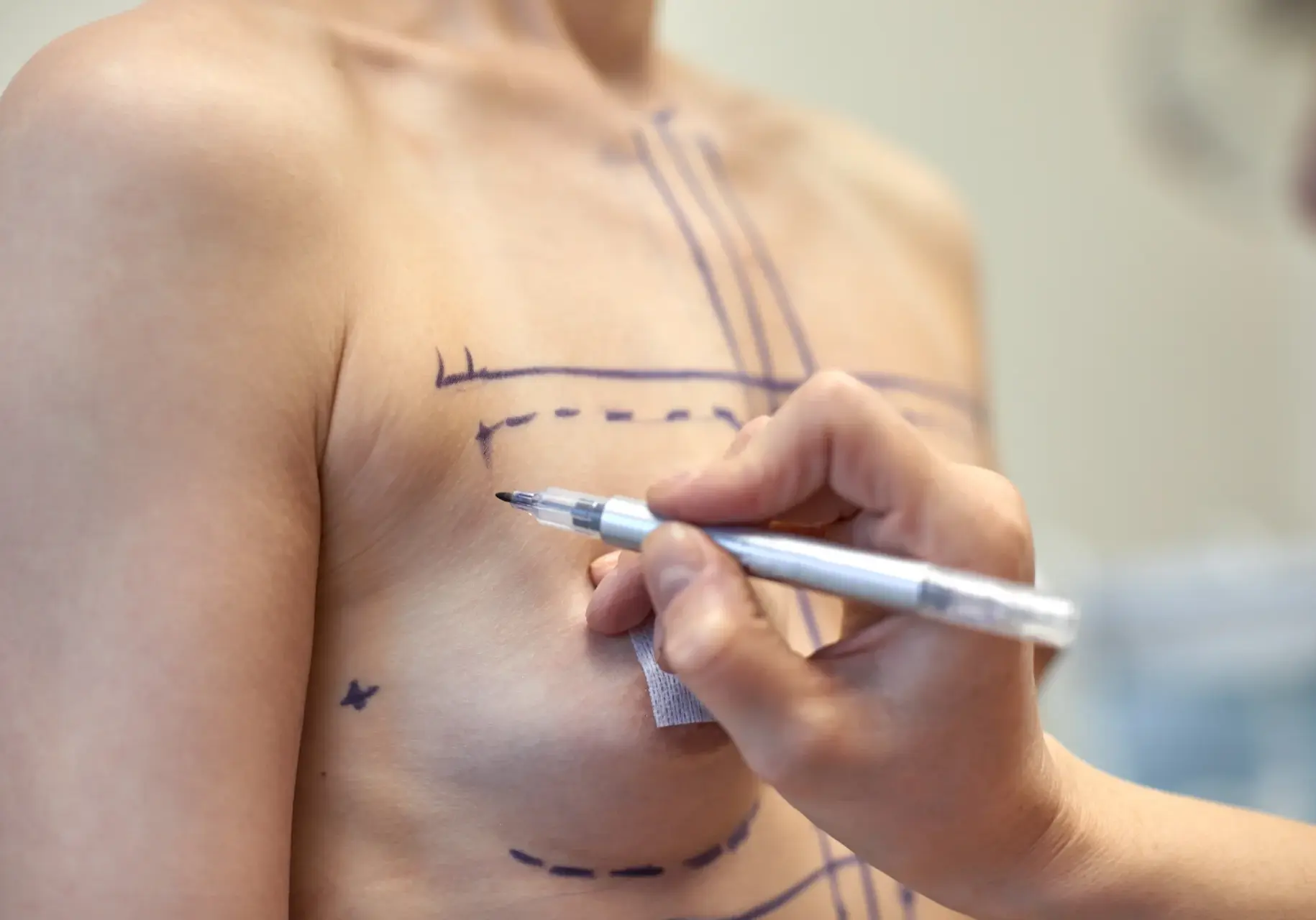 breast-