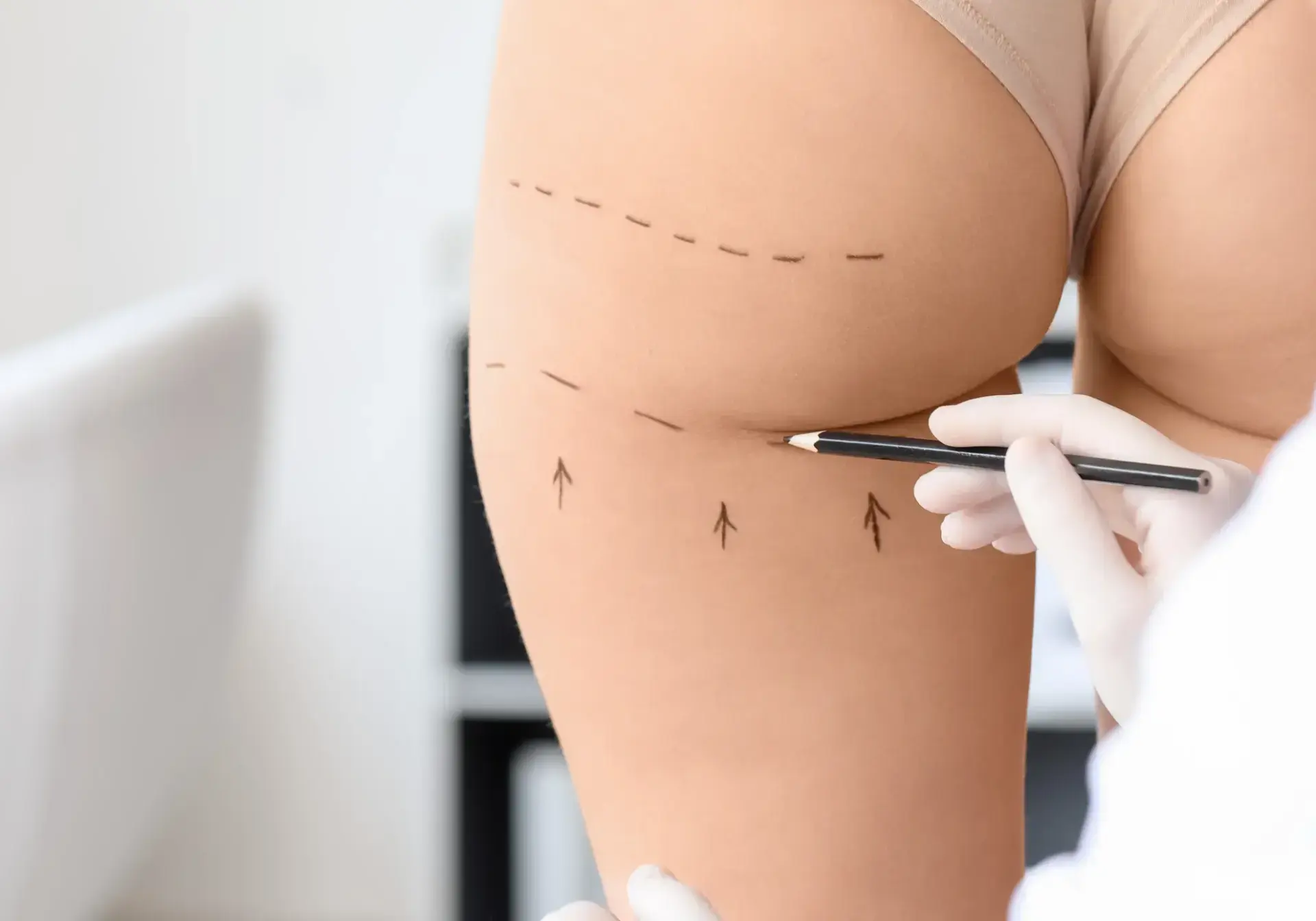gluteos