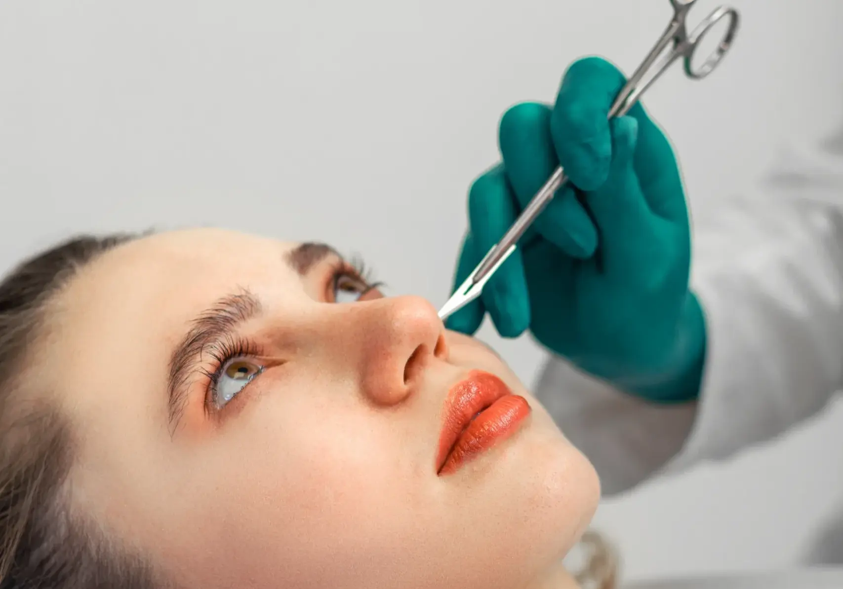 rhinoplasty