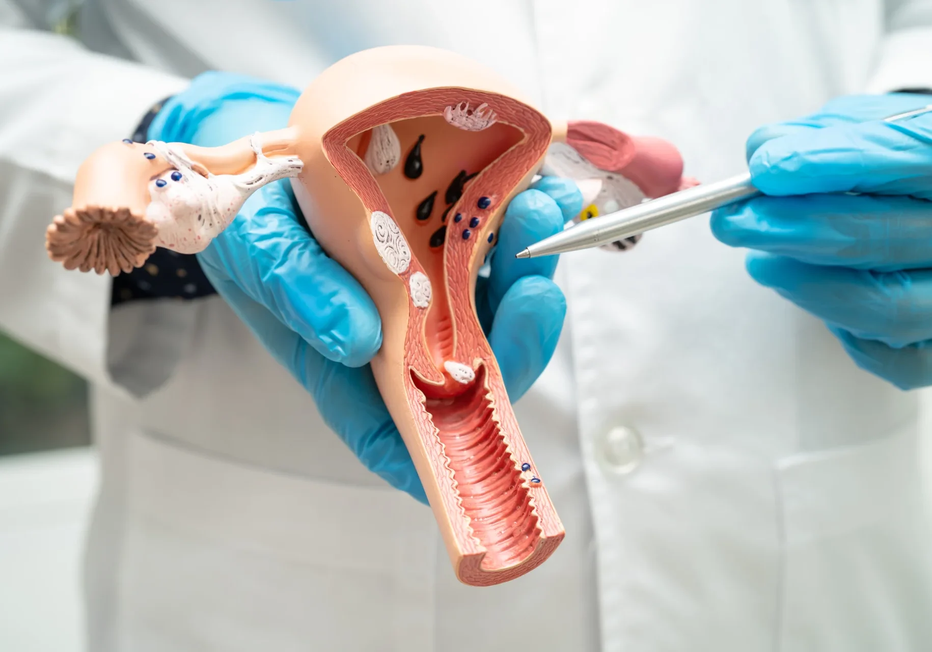 uterus-doctor-holding-anatomy-model-for-study-dia-2025-02-25-08-49-58-utc uterus-doctor-holding-anatomy-model-for-study-dia-2025-02-25-08-49-58-utc